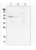 Anti-Caspase-2/CASP2 Antibody Picoband®