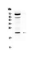 Anti-C19orf80/ANGPTL8 Antibody Picoband®