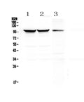 Anti-Dynamin 1/DNM1 Antibody Picoband®