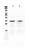 Anti-Caspase-6/CASP6 Antibody Picoband®