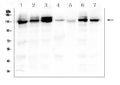 Anti-Integrin alpha 3/ITGA3 Antibody Picoband®