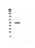 Anti-ANGPTL3 Antibody Picoband®