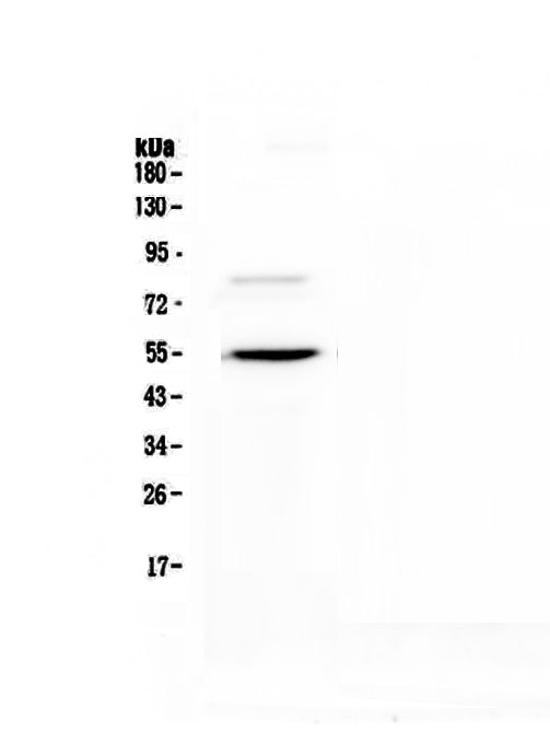 Anti-ANGPTL3 Antibody Picoband®