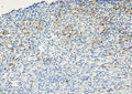 Anti-ABCB5 Antibody Picoband®