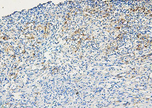 Anti-ABCB5 Antibody Picoband®
