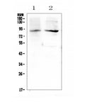 Anti-XPB/ERCC3 Antibody Picoband®