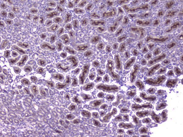 Anti-CCL8 Antibody
