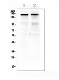 Anti-Thrombospondin 2/THBS2 Antibody Picoband®