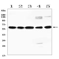 Anti-AVPR1A/V1aR Antibody Picoband®