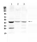 Anti-Prosurfactant Protein B/SFTPB Antibody Picoband®