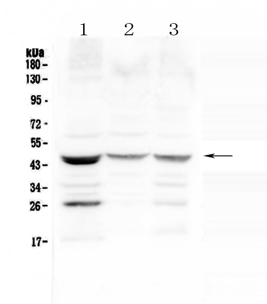 Anti-Prosurfactant Protein B/SFTPB Antibody Picoband®