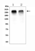 Anti-Acetyl Coenzyme A Carboxylase/ACACB Antibody Picoband®