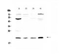 Anti-Kallikrein 2/KLK2 Antibody Picoband®