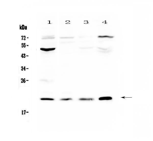 Anti-Kallikrein 2/KLK2 Antibody Picoband®