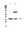 Anti-CD23/FCER2 Antibody Picoband®