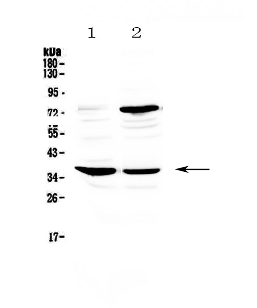 Anti-CD23/FCER2 Antibody Picoband®