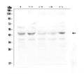 Anti-GPR2/CCR10 Antibody Picoband®