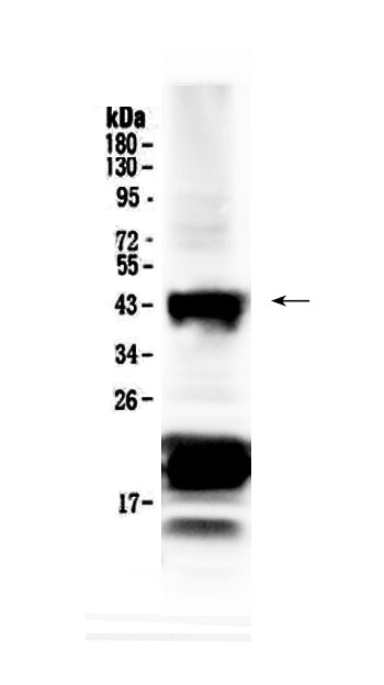 Anti-CHX10/VSX2 Antibody Picoband®
