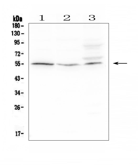 Anti-D6/ACKR2 Antibody Picoband®