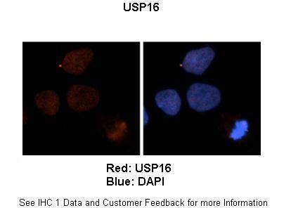 Anti-USP16 Antibody Picoband®