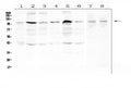 Anti-RSK3/RPS6KA2 Antibody Picoband®