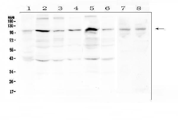 Anti-RSK3/RPS6KA2 Antibody Picoband®
