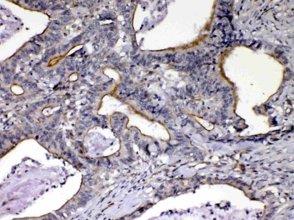 Anti-NOV/CCN3 Antibody Picoband®