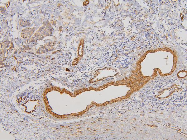 Anti-RAB3GAP2 Antibody Picoband®