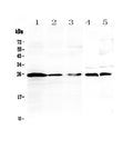 Anti-IL36 alpha/IL36A Antibody Picoband®