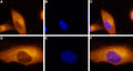 Anti-Adenosine A3 Receptor Antibody