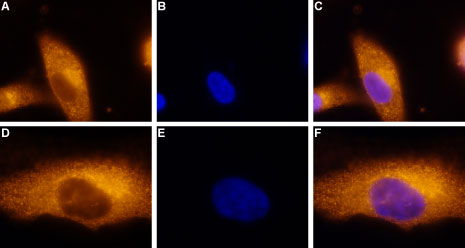 Anti-Adenosine A3 Receptor Antibody