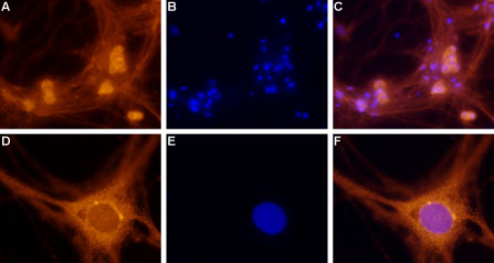 Anti-Adenosine A1 Receptor Antibody