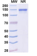 SDS-PAGE for Anti-Dupilumab Neutralizing Antibody (SAA2182)