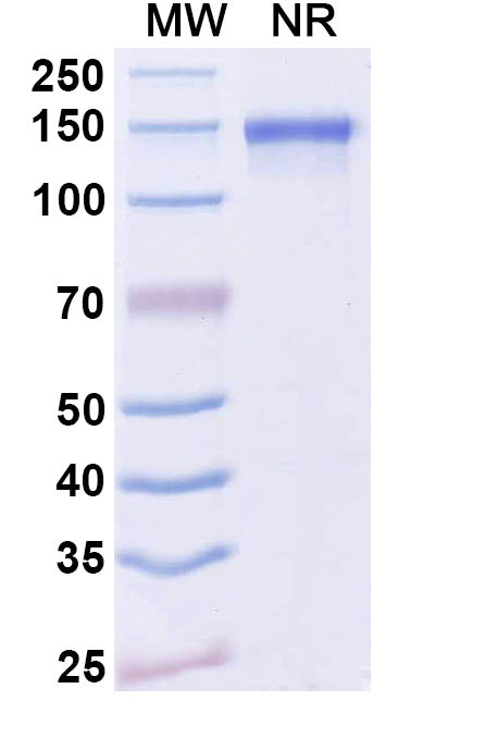 SDS-PAGE for Anti-Dupilumab Neutralizing Antibody (SAA2182)