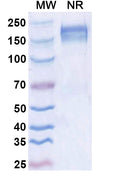 SDS-PAGE for Anti-Dupilumab Neutralizing Antibody (SAA2183)
