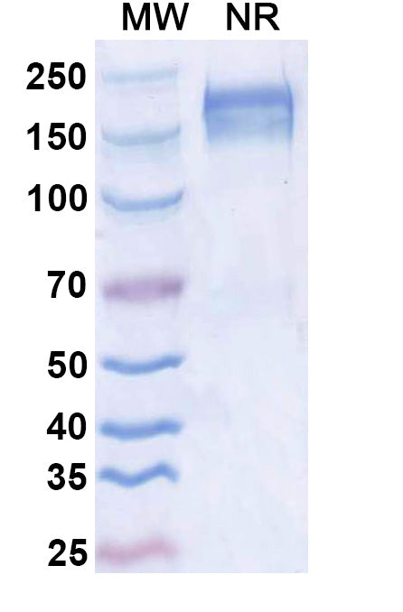 SDS-PAGE for Anti-Dupilumab Neutralizing Antibody (SAA2183)