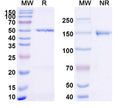 SDS-PAGE for Anti-Dupilumab Non-Neutralizing Antibody (SAA2184)