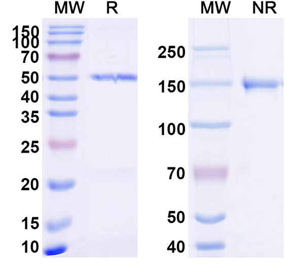 SDS-PAGE for Anti-Dupilumab Non-Neutralizing Antibody (SAA2184)
