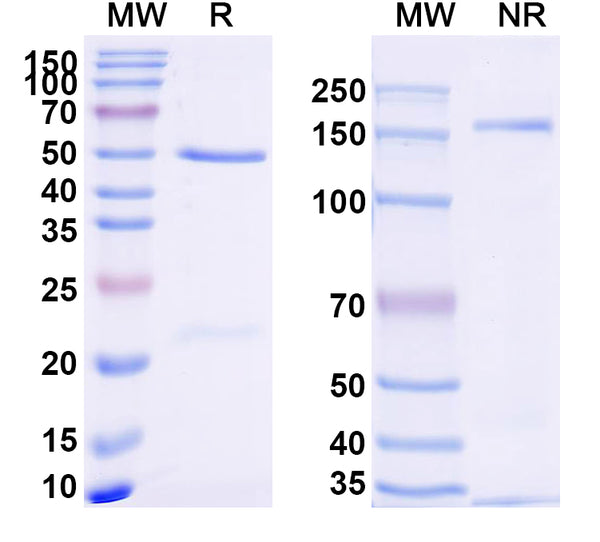 SDS-PAGE for Anti-Dupilumab Non-Neutralizing Antibody (SAA2185)