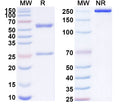 SDS-PAGE for Anti-4G7 scFv Monoclonal Antibody (SAA1997)