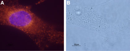 Anti-Bombesin Receptor 1 (NMBR) Antibody