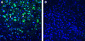Anti-BMPR1A (extracellular) Antibody