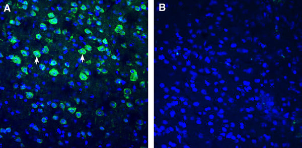 Anti-BMPR1A (extracellular) Antibody