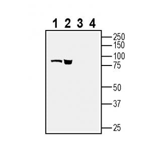 BMPR1A (extracellular) Blocking Peptide