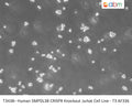 Human SMPDL3B CRISPR Knockout Jurkat Cell Line - T3 AF336 | Applied Biological Materials (abm)