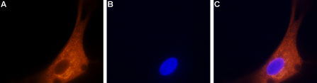 Anti-CACNA1B (CaV2.2) Antibody