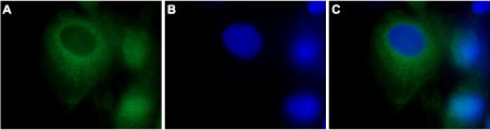 Anti-TRPC3 Antibody