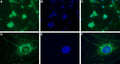 Anti-CaV3.2 (CACNA1H) Antibody