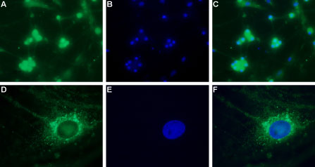 Anti-CaV3.2 (CACNA1H) Antibody