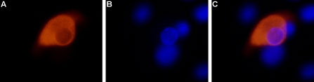 Anti-TRPV1 (VR1) Antibody